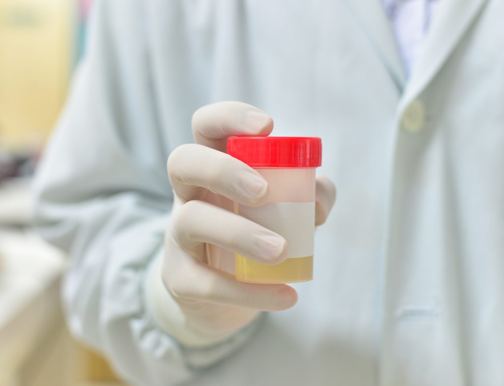 Urine Drug Tests